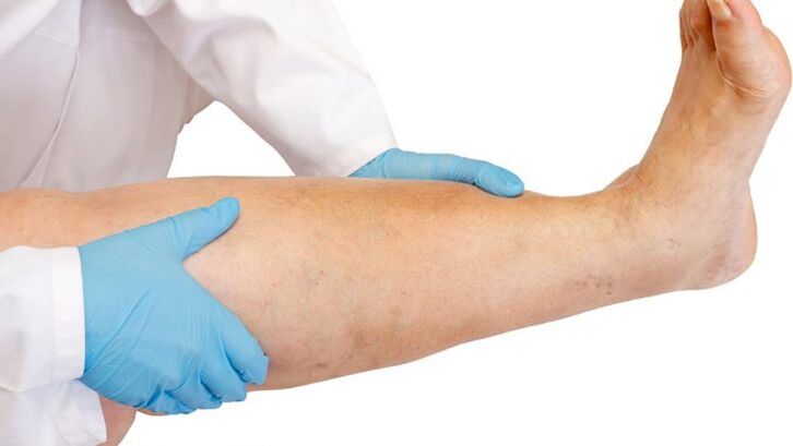 ako identifikovať chorobu